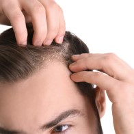 Trichology Treatments (Hair)